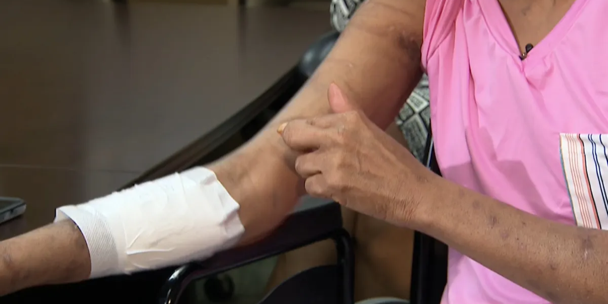 Dog Mauling Leaves 58-Year-Old Woman Fighting for Life, Forced to Undergo Amputation