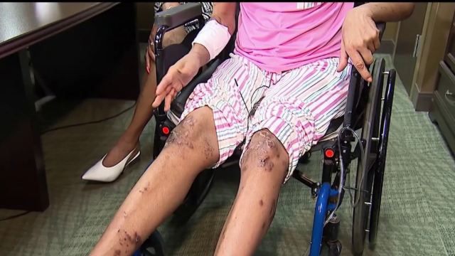 Suburban Residents Demand Answers After Woman Mauled by Dogs