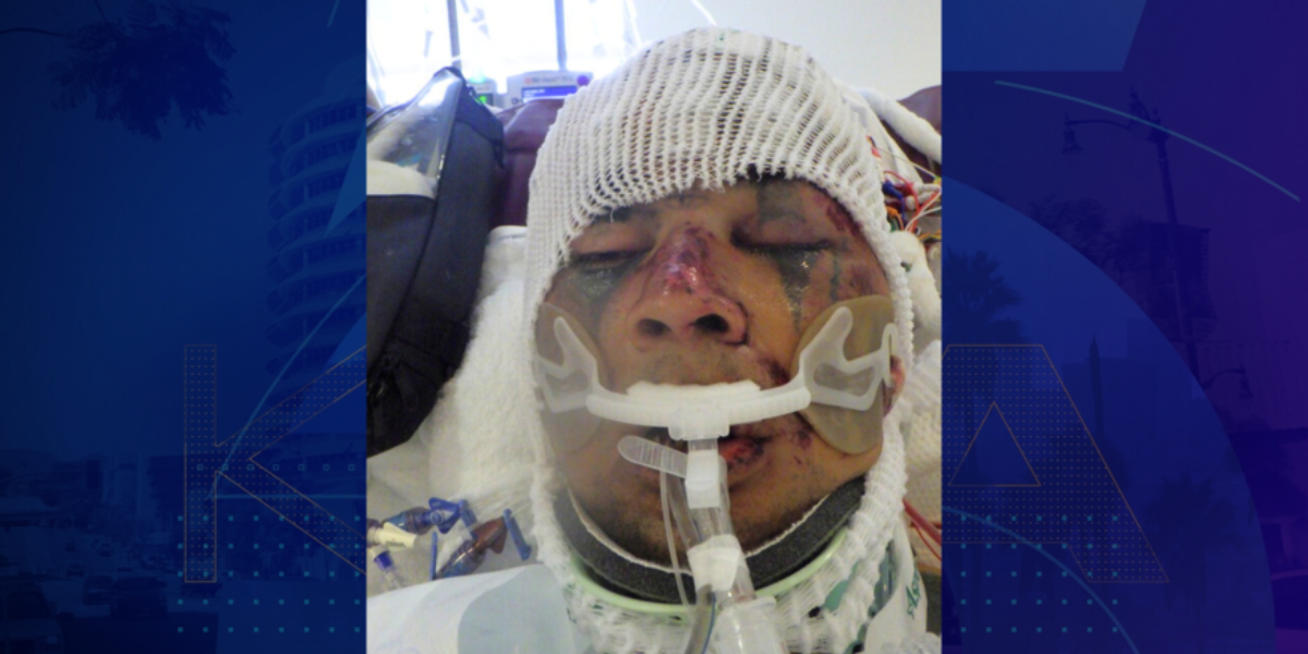 Downtown Los Angeles Authorities Ask for Help Identifying Injured Man