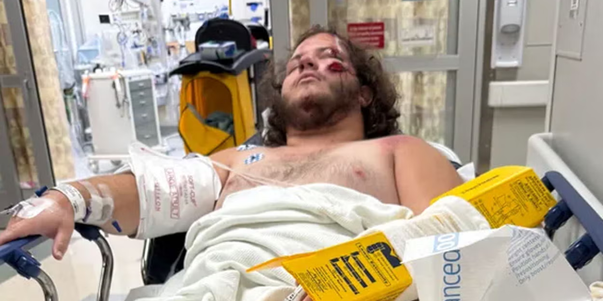 Tennessee Hit-and-Run Leaves 21-Year-Old Seriously Injured, Suspect Still on the Loose