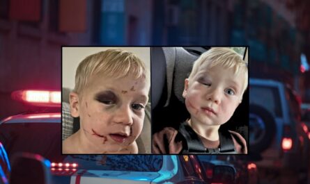 Georgia Daycare Worker Arrested After Toddler Found With Black Eye and Swollen Face
