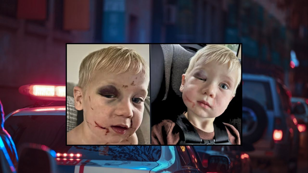 Georgia Daycare Worker Arrested After Toddler Found With Black Eye and Swollen Face