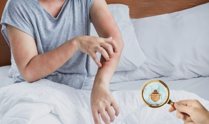Insect Invasion: 6 Ohio Cities Combatting Bed Bug Onslaught