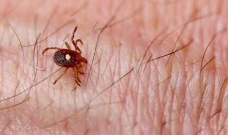 First-Ever Death Linked to Tick-Bite Meat Allergy Alarms Health Experts