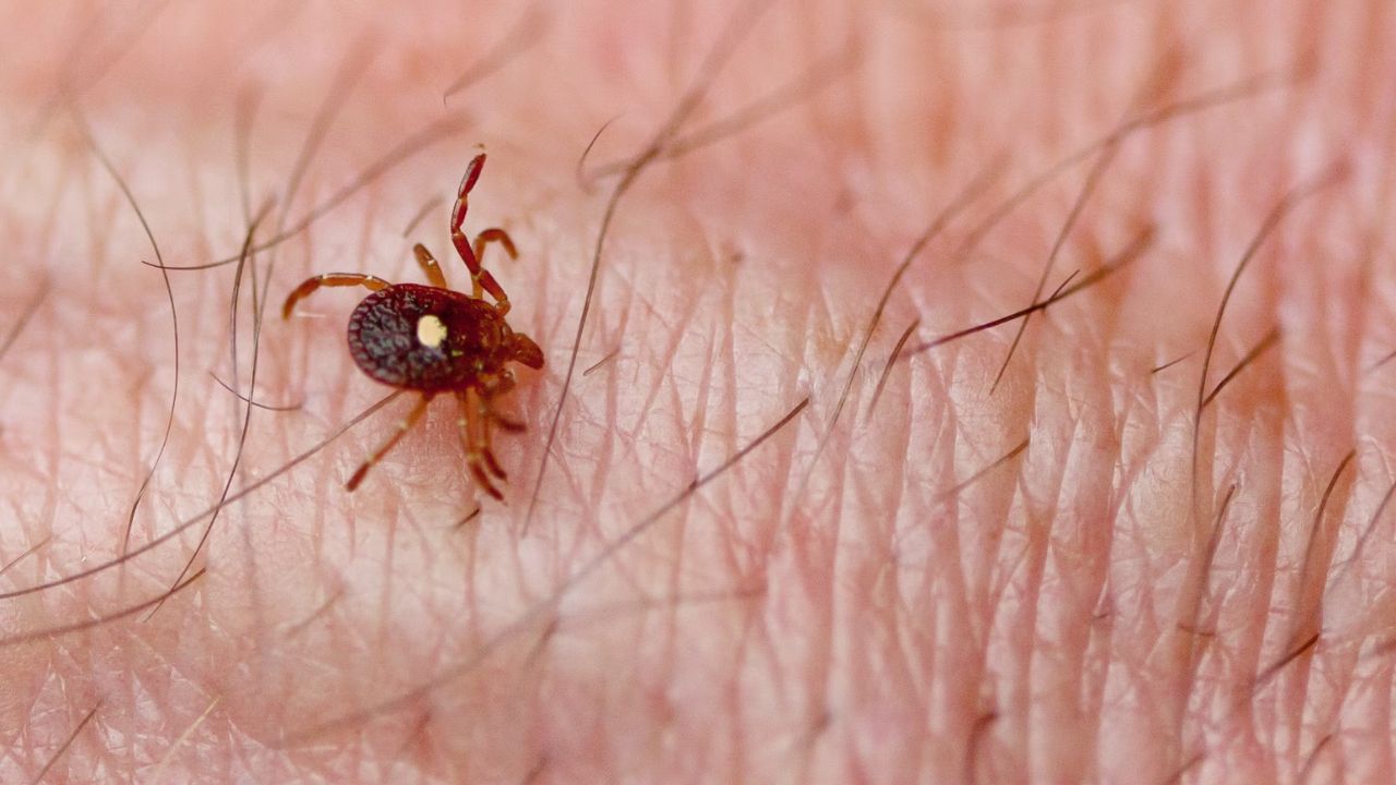 First-Ever Death Linked to Tick-Bite Meat Allergy Alarms Health Experts